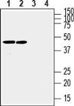Connexin-31 (GJB3) Antibody in Western Blot (WB)