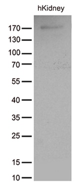 ACE Antibody in Western Blot (WB)