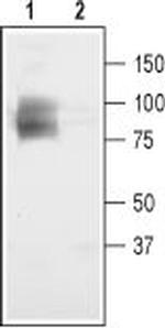 CLC-3 (CLCN3) Antibody in Western Blot (WB)