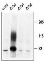 CLC-3 (CLCN3) Antibody in Western Blot (WB)