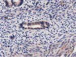 ACOT12 Antibody in Immunohistochemistry (Paraffin) (IHC (P))