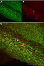 Cannabinoid Receptor 1 (extracellular) Antibody in Immunohistochemistry (IHC)