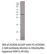 Atypical Chemokine Receptor D6 Antibody in Western Blot (WB)