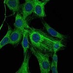 Alpha-Smooth Muscle Actin Antibody in Immunocytochemistry (ICC/IF)