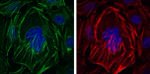 Alpha-Smooth Muscle Actin Antibody in Immunocytochemistry (ICC/IF)