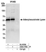 Adenylosuccinate Lyase/ADSL Antibody in Western Blot (WB)