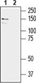 EphA6 (extracellular) Antibody in Western Blot (WB)