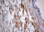 AFAP1 Antibody in Immunohistochemistry (Paraffin) (IHC (P))