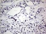 AFAP1 Antibody in Immunohistochemistry (Paraffin) (IHC (P))