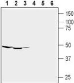 GABA(A) alpha 1 Receptor (extracellular) Antibody in Western Blot (WB)