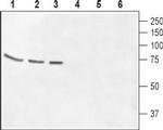 GABA(A) theta Receptor (GABRQ) (extracellular) Antibody in Western Blot (WB)