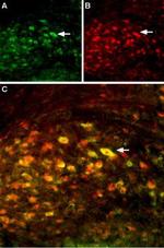 NMDAR2A (GluN2A) (extracellular) Antibody in Immunohistochemistry (Frozen) (IHC (F))