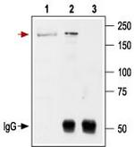 NMDAR2B (GluN2B) (extracellular) Antibody in Immunoprecipitation (IP)