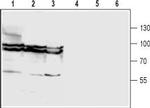 GlyT1 (SLC6A9) (extracellular) Antibody in Western Blot (WB)