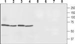 Ferroportin (SLC40A1) Antibody in Western Blot (WB)