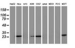 AK4 Antibody in Western Blot (WB)