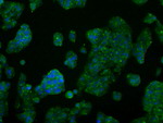 AKT2 Antibody in Immunocytochemistry (ICC/IF)