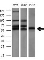 AKT2 Antibody in Western Blot (WB)