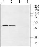 LPAR6 (P2RY5) (extracellular) Antibody in Western Blot (WB)