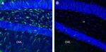 CLEC7A/Dectin-1 (extracellular) Antibody in Immunohistochemistry (Frozen) (IHC (F))