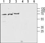 Nicotinic Acetylcholine Receptor beta 2 (CHRNB2) (extracellular) Antibody in Western Blot (WB)