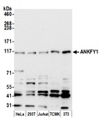 ANKFY1 Antibody in Western Blot (WB)