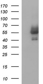 ANKMY2 Antibody in Western Blot (WB)