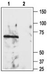 Nogo Receptor (extracellular) Antibody in Western Blot (WB)