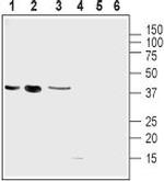 UCP2 Antibody in Western Blot (WB)