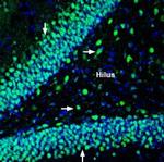 Na+/H+ Exchanger 6 (NHE-6) Antibody in Immunohistochemistry (Frozen) (IHC (F))