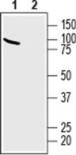 Na+/H+ Exchanger 6 (NHE-6) Antibody in Western Blot (WB)