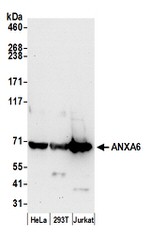 ANXA6 Antibody in Western Blot (WB)