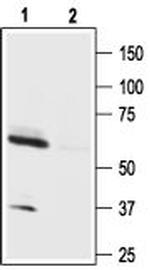 Orexin Receptor 1 Antibody in Western Blot (WB)