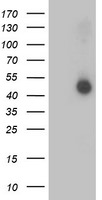 AP2M1 Antibody in Western Blot (WB)