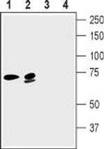 KCNN2 (KCa2.2, SK2) Antibody in Western Blot (WB)