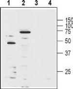 KV1.3 (KCNA3) (extracellular) Antibody in Western Blot (WB)