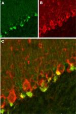 KV beta 2 Antibody in Immunohistochemistry (IHC)