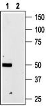 P2X4 Receptor Antibody in Western Blot (WB)