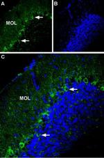 P2X1 Receptor (extracellular) Antibody in Immunohistochemistry (IHC)