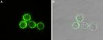 PTH1R (extracellular) Antibody in Immunocytochemistry (ICC/IF)