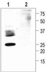 Aquaporin 2 Antibody in Western Blot (WB)