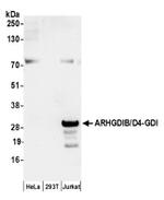 ARHGDIB/D4-GDI/RhoGDI2 Antibody in Western Blot (WB)