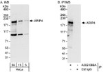 ARIP4 Antibody in Western Blot (WB)