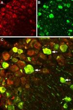 NaV1.7 (SCN9A) Antibody in Immunohistochemistry (IHC)