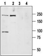 NaV1.7 (SCN9A) Antibody in Western Blot (WB)