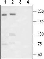 NaV1.7 (SCN9A) (extracellular) Antibody in Western Blot (WB)