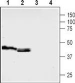 5HT5B Receptor (HTR5B) (extracellular) Antibody in Western Blot (WB)