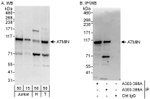 ATMIN Antibody in Western Blot (WB)