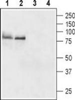 TSH Receptor (TSHR) (extracellular) Antibody in Western Blot (WB)