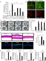 Actin (muscle) Antibody in Immunohistochemistry (IHC)